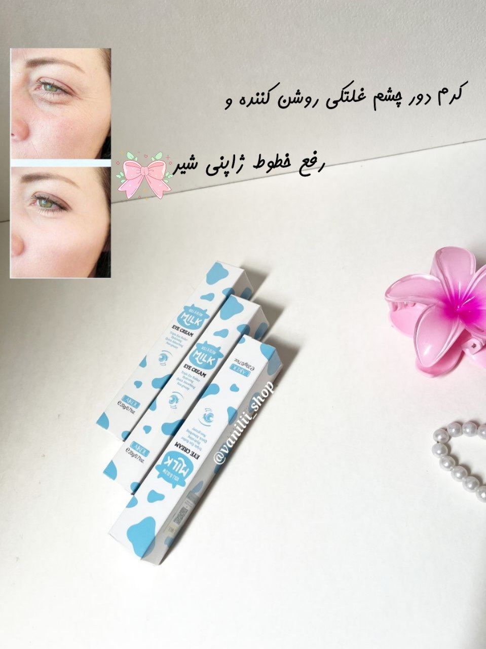 کرم دور چشم غلتکی ژاپنی