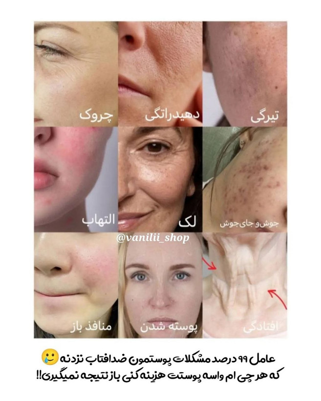 ضدآفتاب تینتی استلین