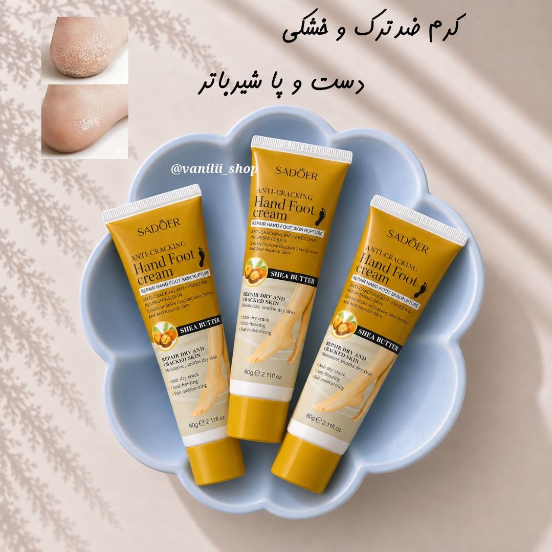 کرم شیرباتر رفع خشکی و ترک دست و پا