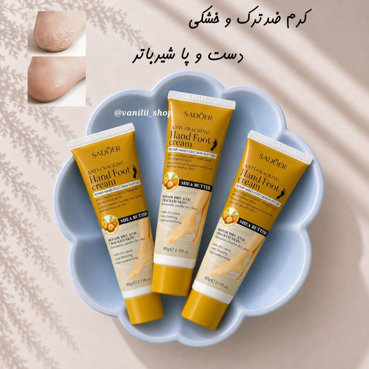 کرم شیرباتر رفع خشکی و ترک دست و پا