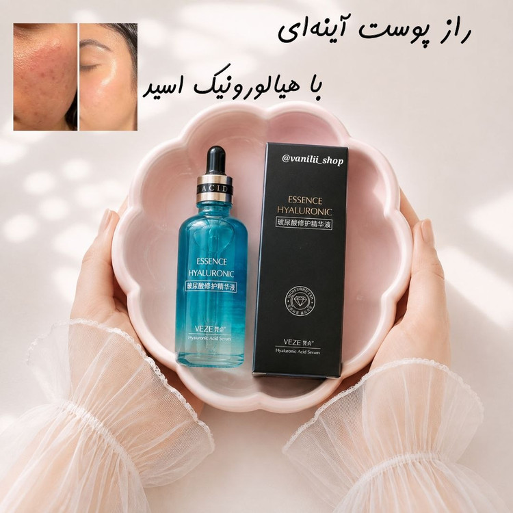سرم رفع خشکی و درمانی هیالورونیک اسید